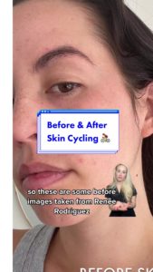 Le SKIN CYCLING, la nouvelle tendance skincare qui affole les réseaux!, bicom